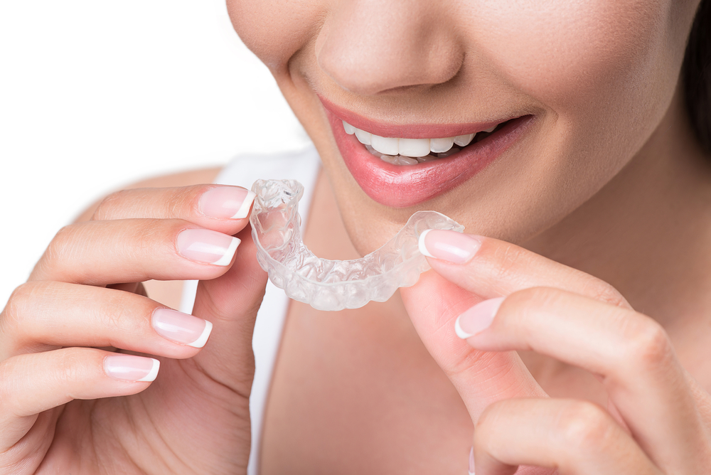 Aligner treatment Aligner treatment