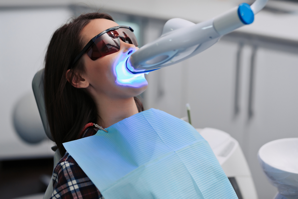 Teeth Bleaching