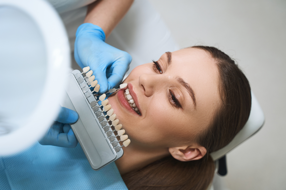 Teeth Veneers Teeth Veneers